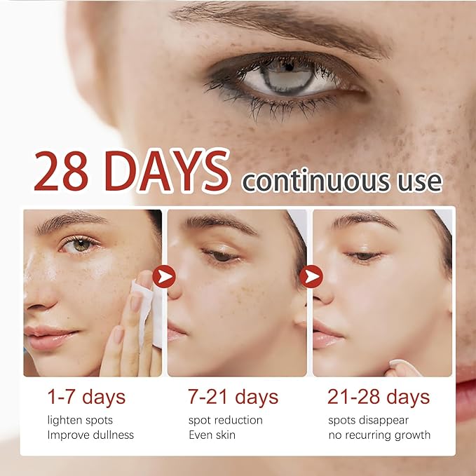 Eelhoe Dark Spot & Pigment Correcting Cream