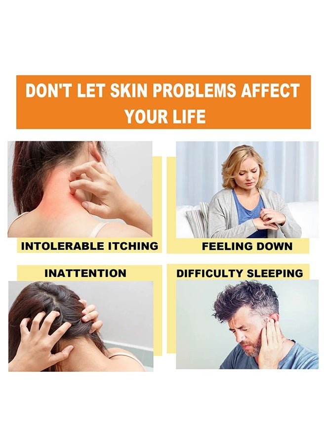 South Moon Bee Venom Psoriasis Cream for Itch & Flare-Up Relief | Natural Skin Soothing