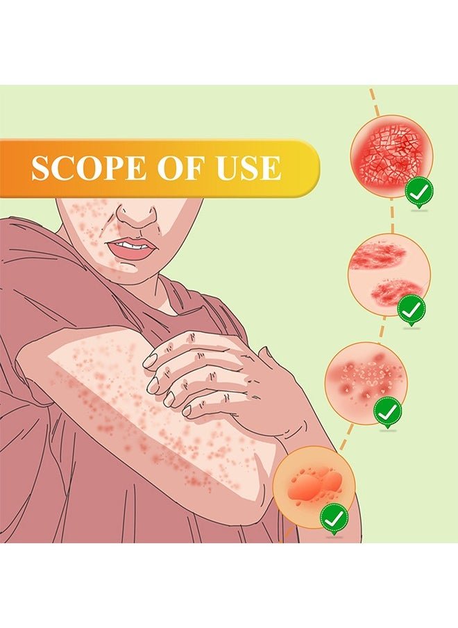 South Moon Bee Venom Psoriasis Cream for Itch & Flare-Up Relief | Natural Skin Soothing