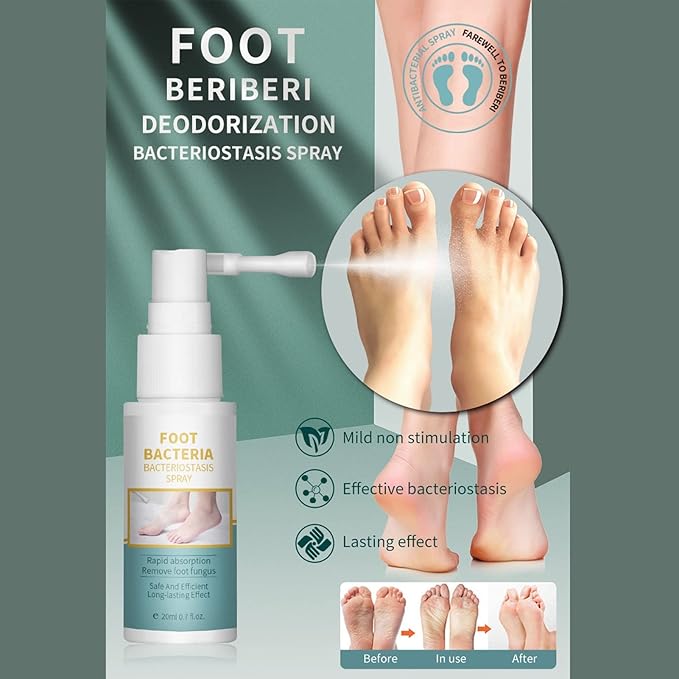 🔥Ansiyi Original Foot Spray – Antibacterial, Anti-Fungal, Odor Removal & Bacteriostasis Protection