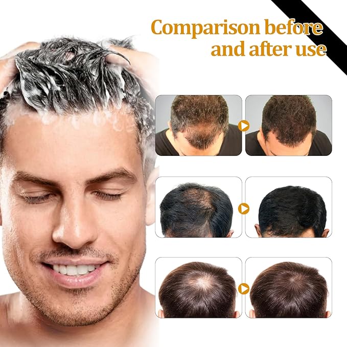 Eelhoe Hair Regrowth Shampoo