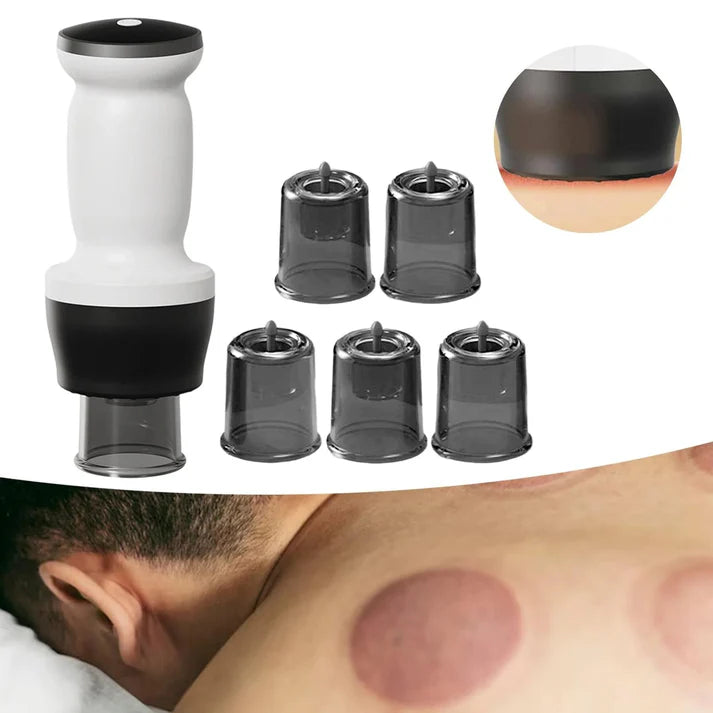 🔥Smart Cupping Therapy Massager