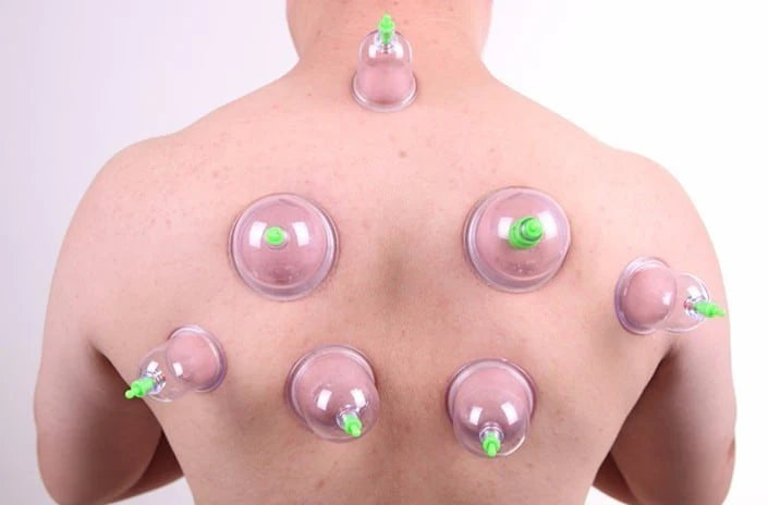 KN Vacuum Therapy Cup