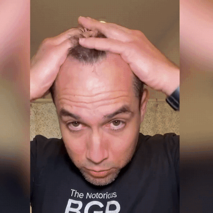 🔥Natural Hair Growth Spray