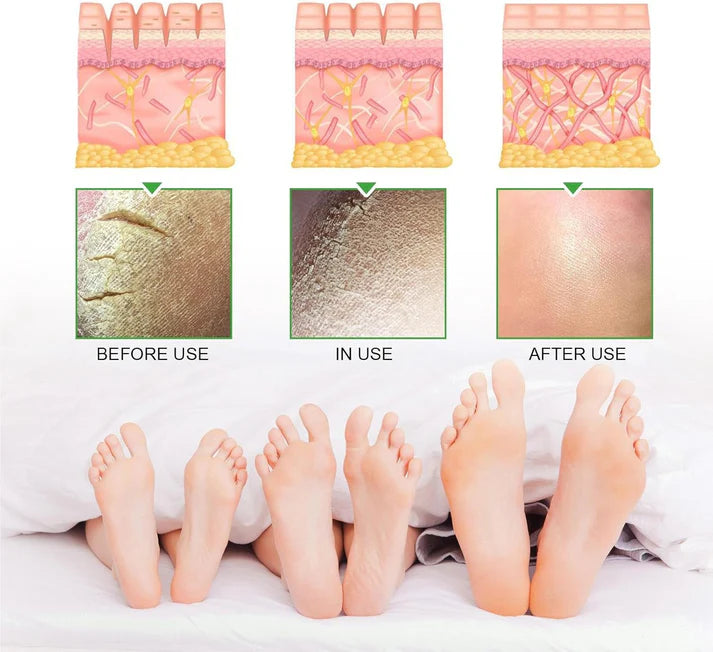 South Moon Intensive Foot & Heel Repair Cream