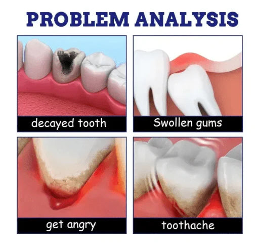 Tooth Pain Relief Spray