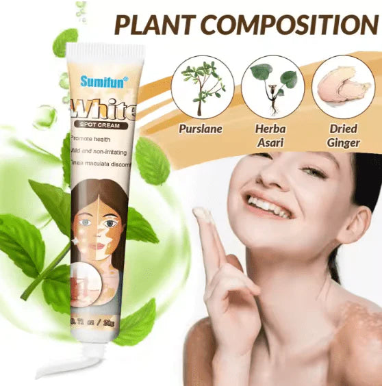 Sumifun Vitiligo Treatment Cream